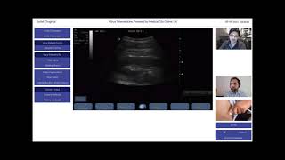 Renal Tele Ultrasonography - Remote Ultrasound Scanning of Kidney using ordinary machines