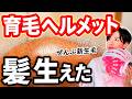 【4ヶ月検証】赤色LEDで髪生えました【育毛ヘルメット】