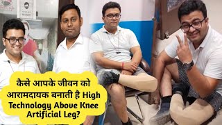 Comfort and Easy life With Above Knee Artificial limbs with Hydraullic  Knee Joint OSSUR||Bornlife