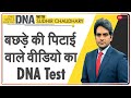 DNA: वायरल वीडियो से समझिए, कितने तनाव में रहते हैं भारतीय | Sudhir Chaudhary | Viral Video | Delhi