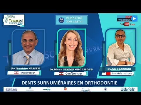 Vidéo: Les dents surnuméraires sont-elles rares ?