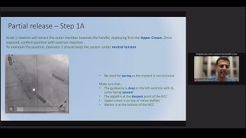 Lecture on Accurate Neo 2 - Valve Design and Implantation Steps - Dr Sengottuvelu.G