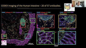 From Molecules to Multicell Modules: Immune-Mediated Tissue Restructuring