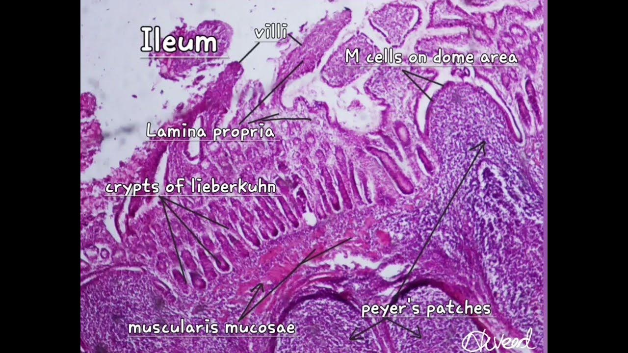 The Ileum under light microscope YouTube