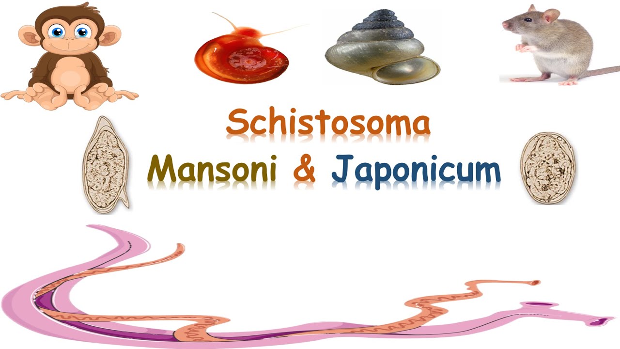 شرح schistosoma mansoni & japonicum - Intestinal schistosomiasis