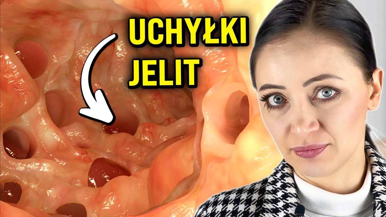 Co Zrobić żeby Włosy Rosły Jak Szalone To są uchyłki jelit. 10 sposbów, jak im zapobiec - YouTube