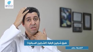 ضيق شرايين الرقبة (الشرايين السباتية) | د. فاروق حسن - عيادات مصرية التخصصية