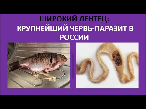18. Широкий лентец: крупнейший червь-паразит в России