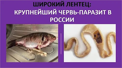 18. Широкий лентец: крупнейший червь-паразит в России