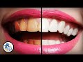 What's The Best Way To Whiten Teeth?