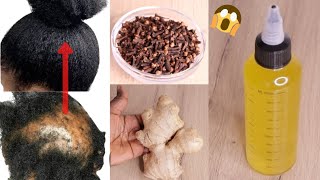 MIX GINGER & CLOVE AND YOUR HAIR & BALDNESS WILL GROW 3 TIMES UNSTOPPABLE FASTER