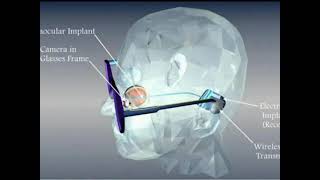 Details Bionic eye | Explained in Tamil | Naveen | Naveen Speaks #shorts #naveenspeaks #naveen News