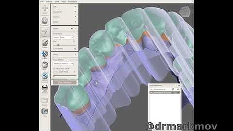 Meshmixer - Blockout Undercuts (EXPLAINED)