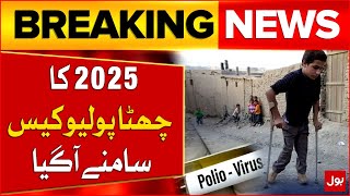 Sixth Polio Case of 2025 Reported in Pakistan | Polio Virus Latest Updates | Breaking News