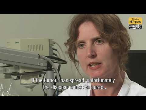 Video: Diagnostic Atipic Pentru Carcinoidul Pulmonar Tipic