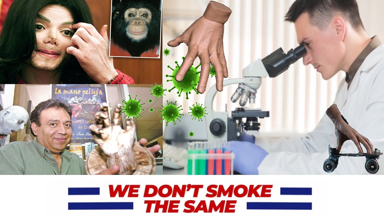 We Don't GLOBITO the Same with Three Plates Tommy