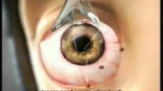 Eye Mo - Mata Segar Semula