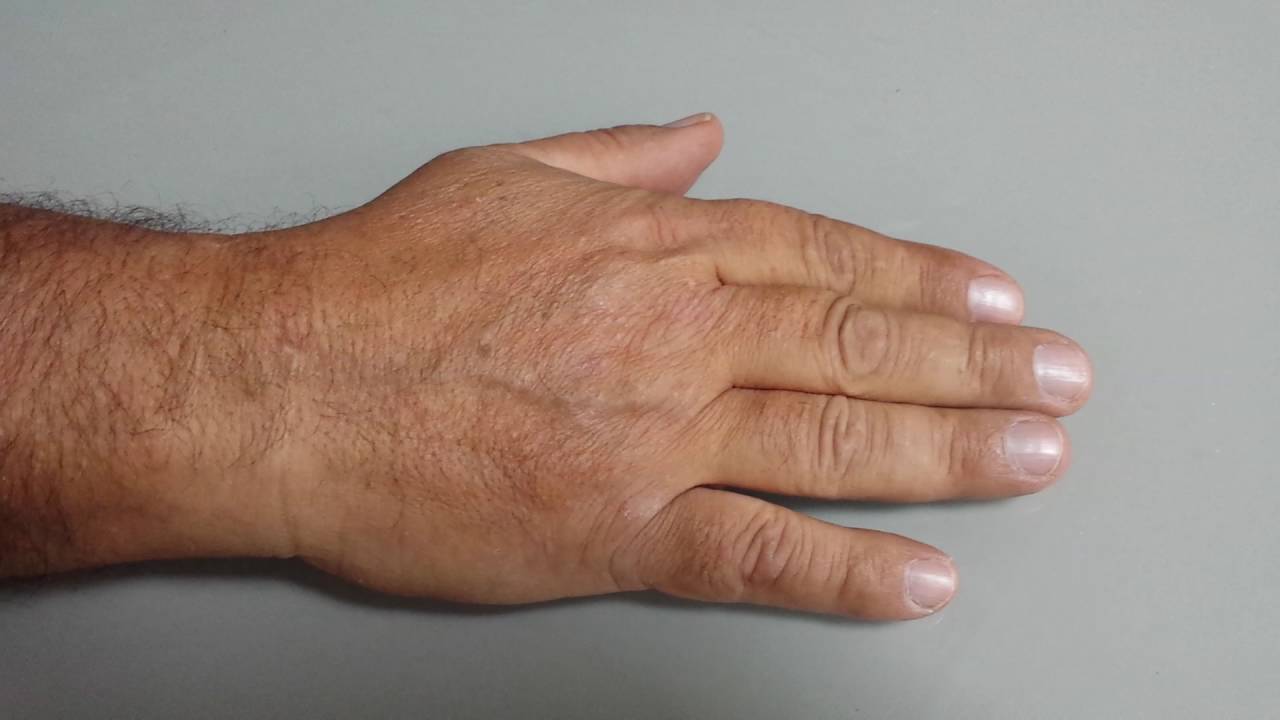 5 second skin test YouTube