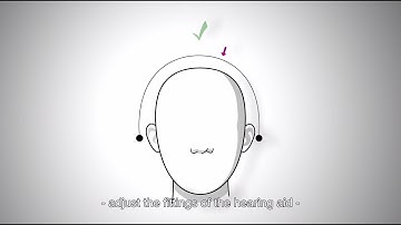 Optimized sound experience when wearing both a hearing aid and a cochlear implant
