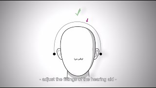 Optimized sound experience when wearing both a hearing aid and a cochlear implant
