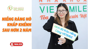 Tháo niềng răng hô, khấp khểnh sau hơn 2 năm