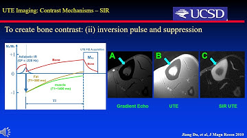 Ya Jun Ma:  Short T2 Imaging Using a 3D DIR-UTE-Cones sequence