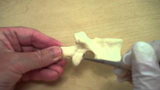 A Typical Vertebra