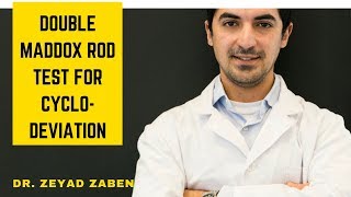 Double Maddox Rod Test for cyclo deviation  كيفية قياس الحول الدوراني بإستخدام