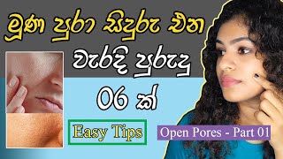 Open pores treatment sinhala ⏐ How to get rid of Open Pores ⏐ Open pores තියෙන අය නොකළ යුතු දේවල්