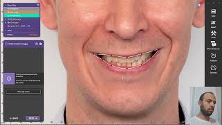 تصميم ال dental bridge ومعرفة كل ما يتعلق ب Digital smile design || حصة 2 || exocad course