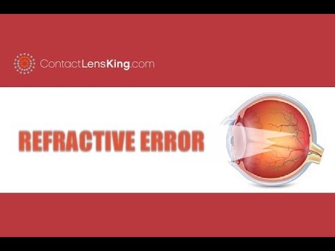 Refractive Error of Eye | Common Refractive Errors | Myopia, Hyperopia, Astigmatism, and Presbyopia