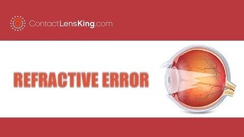 Refractive Error of Eye | Common Refractive Errors | Myopia, Hyperopia, Astigmatism, and Presbyopia