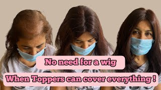 Your Hair Loss / Bald spots can be covered with Hair Toppers | Nish Hair