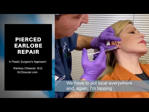 Pierced Earlobe Repair | Ramsey Choucair M.D. | Dallas, TX |214-389-9797