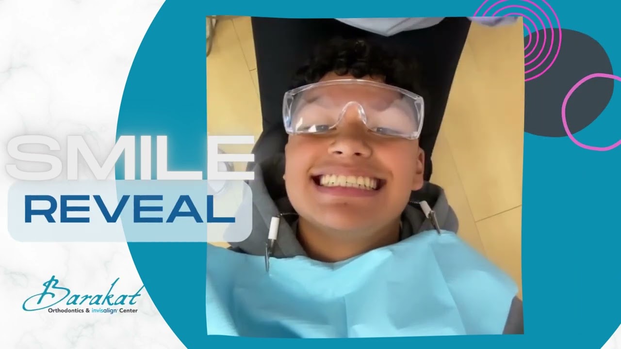 Smile Reveal- Braces Off! | Sterling, Virginia