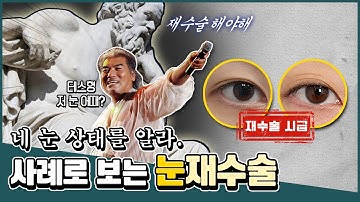 ??‍♀️재수술은 무조건 절개? No! ✨사례로 알아보는 자연유착 눈 재수술!✨ | iWELL Plastic Surgery 아이웰성형외과