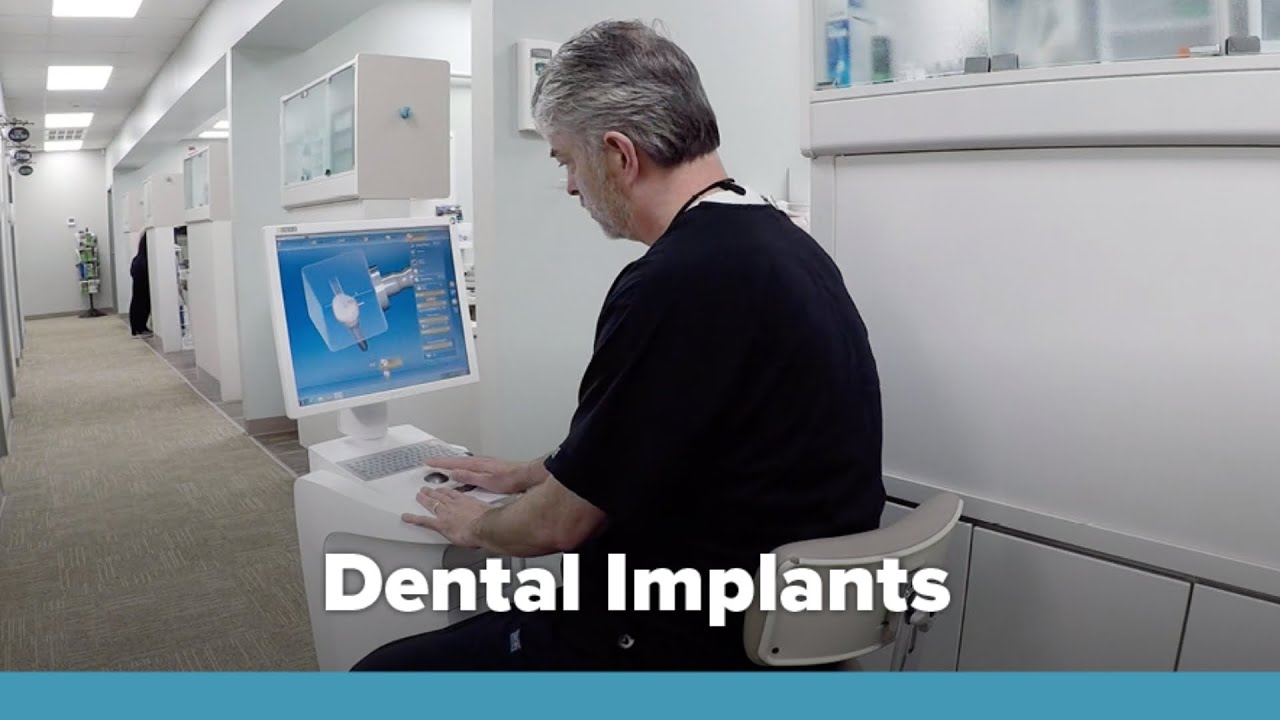 A Permanent Solution to Missing Teeth at Willis Dental Care YouTube