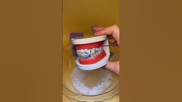 Create Your Own Tooth Gem at Home