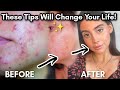 5 Skincare Tips That Will Change Your Skincare Game!!!!