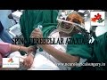 Spino Cerebellar Ataxia Treatment | Dr. Paresh Doshi
