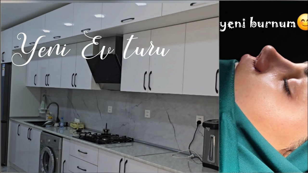 Yeni Ev Çəkilişi + Burun Əməliyyatı Sonrası İlk Günlərim 🏡👃✨#hometour  #dayvlog 
