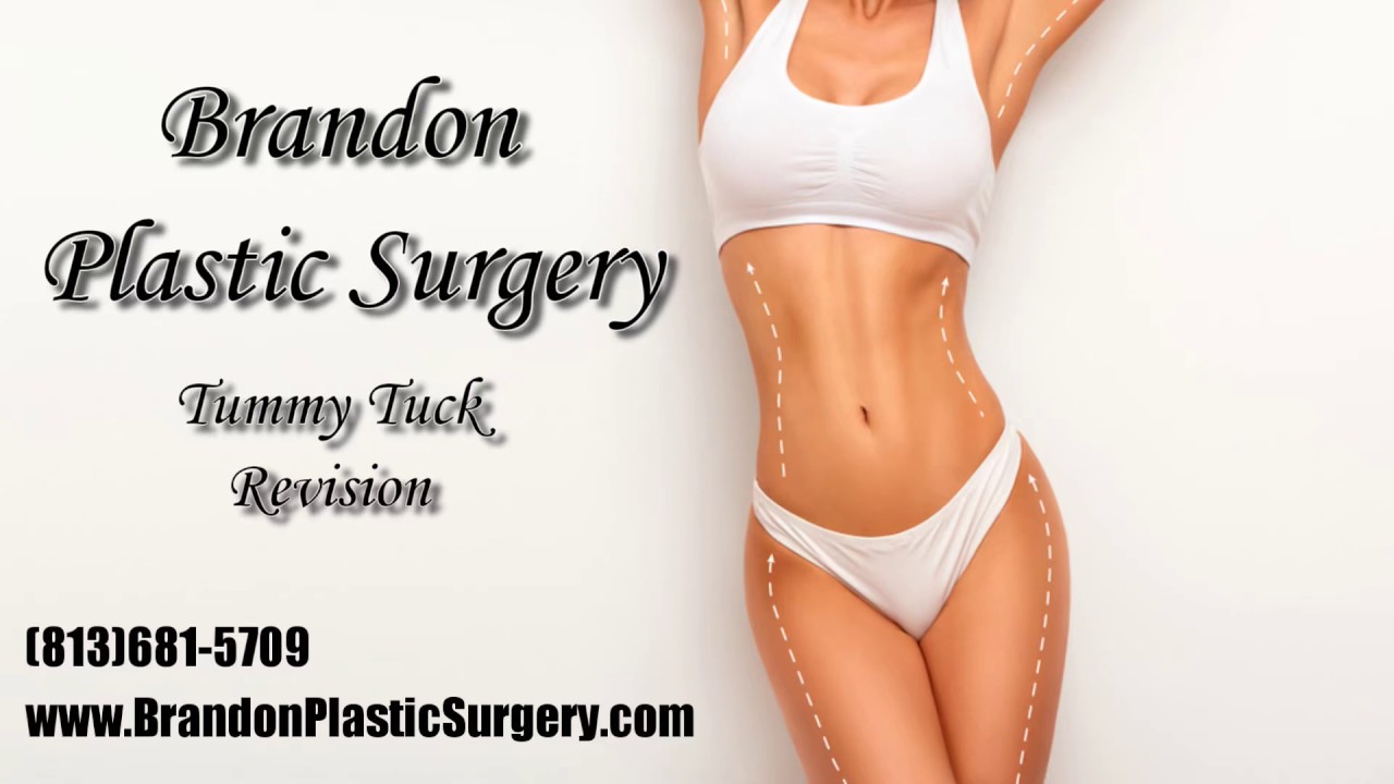 Revision Tummy Tuck YouTube