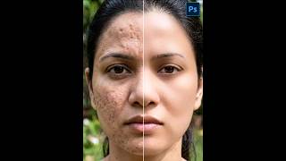 How to Skin Retouch Using Frequency Separation in Adobe Photoshop Like a Pro
