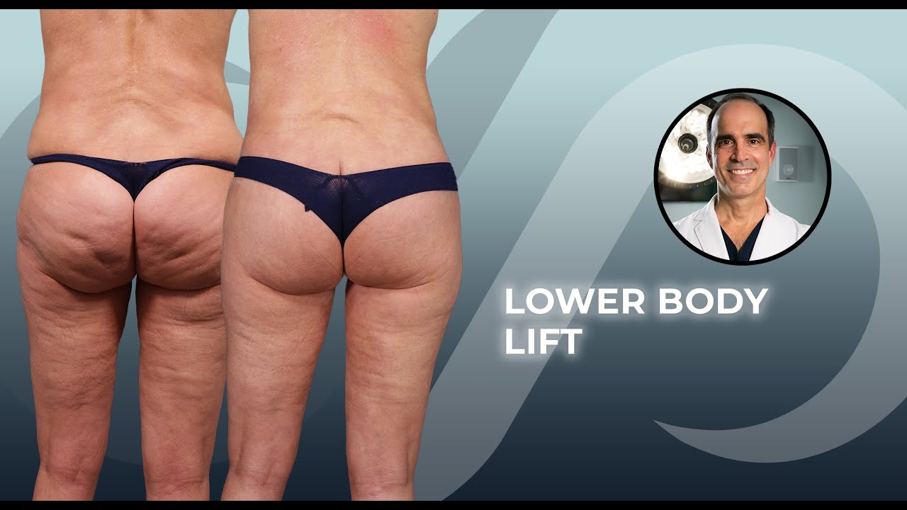 Before And After Lower Body Lift Surgery Transform Your Figure YouTube ftm-top-surgery-total-cost-youtube