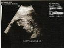 Our Little Peanut