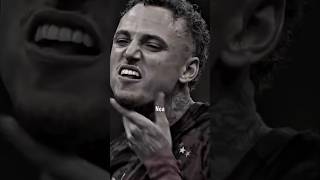 Noa Langın Parmağı Koptu...