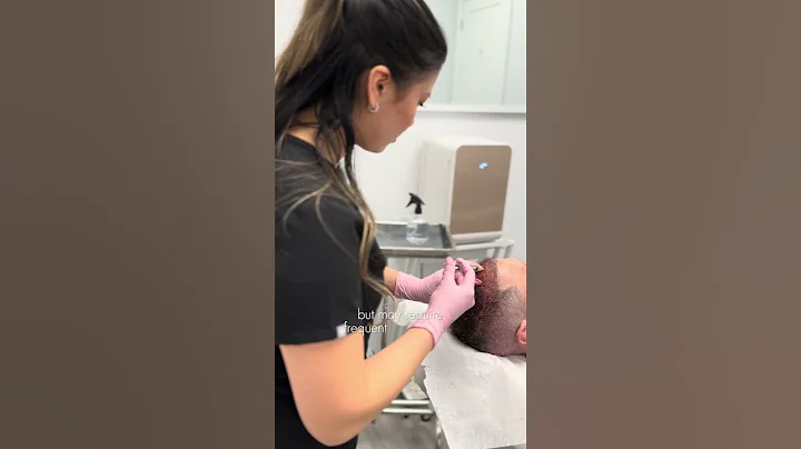 Exosomes vs. PRP Whats Better for Hair Restoration?