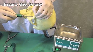 Orbital Rim Fracture Fixation with the Bioabsorbable Inion CPS™ System