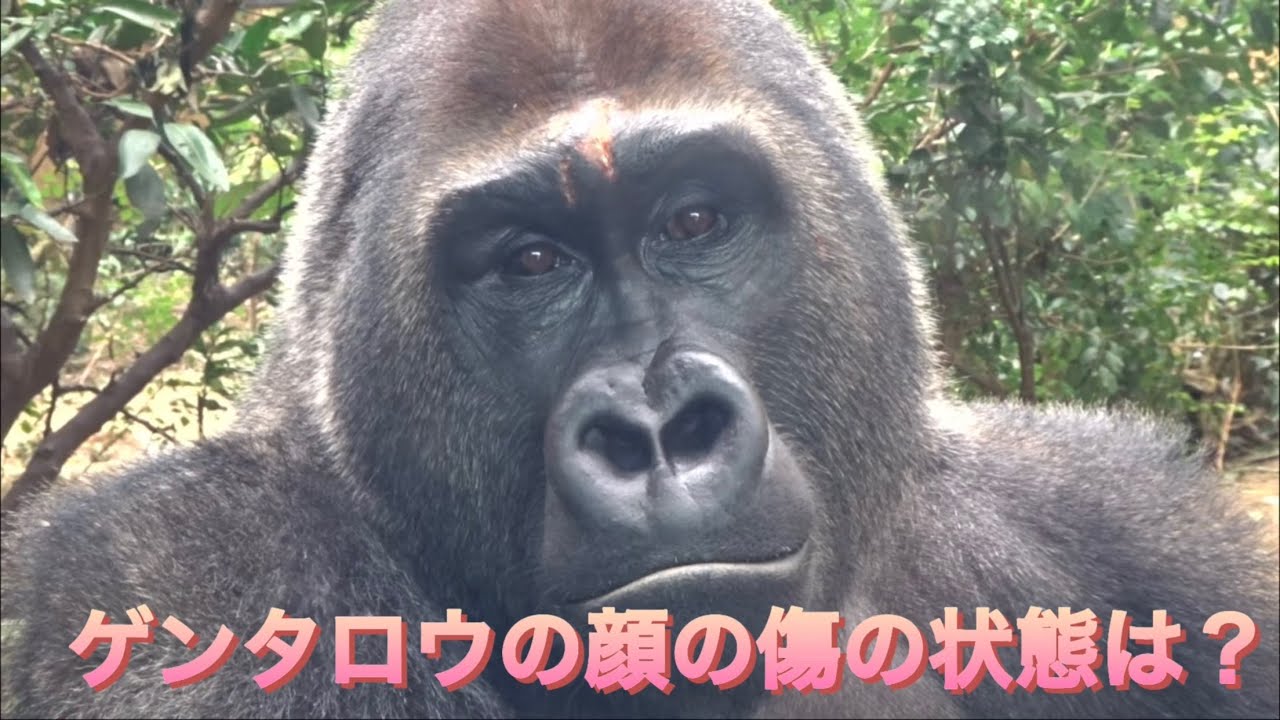 Gorilla⭐️I went to check on how Gentaro's facial wounds were