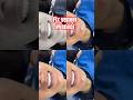 Fix veneer #veneers #dentist #shorts